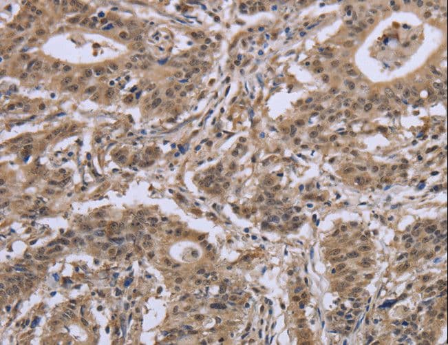 IPO8 / Importin 8 Antibody