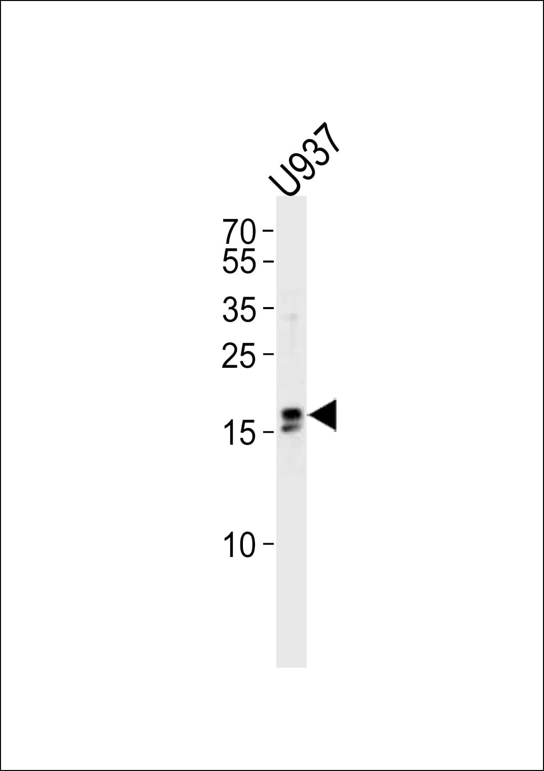 IQCF6 Antibody (aa1-30)