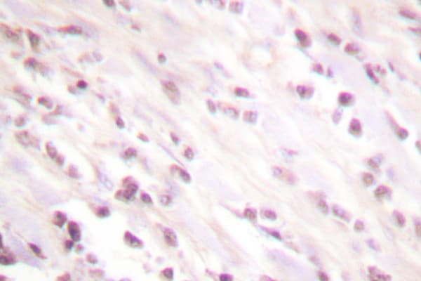 CHEK2 / CHK2 Antibody (Met381)