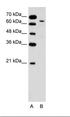 KRT2 / CK2 / Cytokeratin 2 Antibody (aa351-400, FITC)