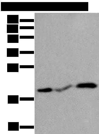CSRP3 Antibody