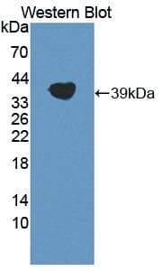 LPA / Lipoprotein a Antibody (aa4227-4546)