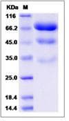 Human PLBD2 Protein (Recombinant His,C-terminus)