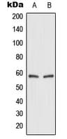 IHC-plus™ Polyclonal Rabbit anti-Human SLC2A2 / GLUT2 Antibody (Internal, IHC, WB)