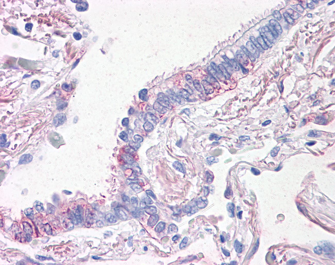 IHC-plus™ Prominin 2 / PROM2 Antibody (N-Terminus)