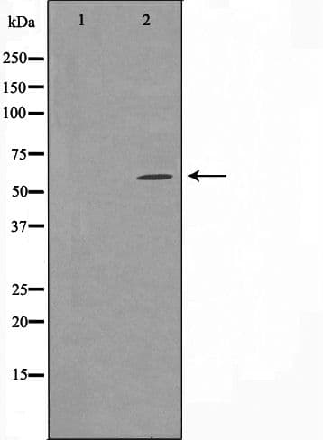 Polyclonal Rabbit anti-Human CYP24 / CYP24A1 Antibody (IF, WB)