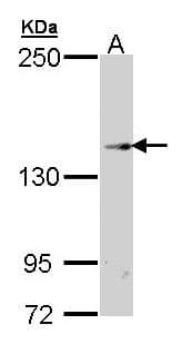 TRPM2 Antibody (aa181-423)