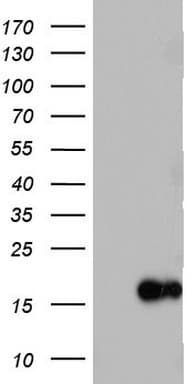 IL1RN Antibody (clone OTI4E8)