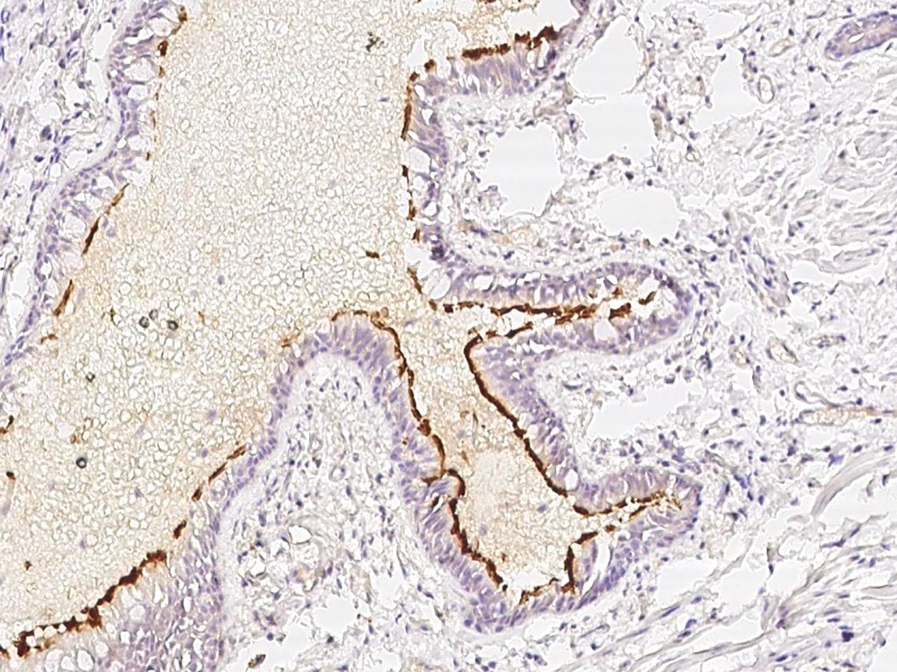 Polyclonal Rabbit anti-Human TMEM237 / ALS2CR4 Antibody (IHC)