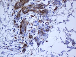 KRT5 / CK5 / Cytokeratin 5 Antibody (clone OTI6F8)