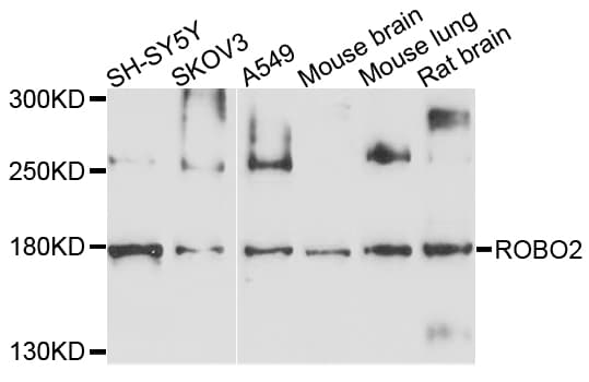 IHC-plus™ ROBO2 Antibody