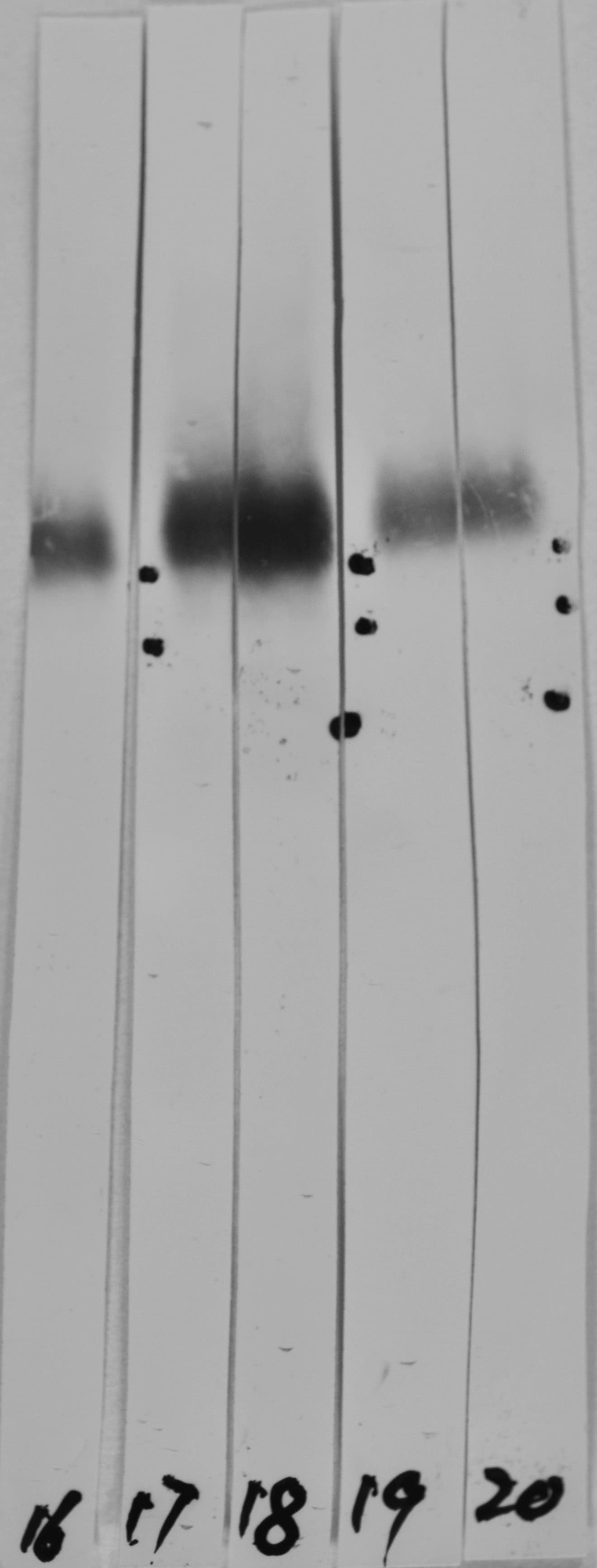 IHC-plus™ LAMP1 / CD107a Antibody (clone 6E2)