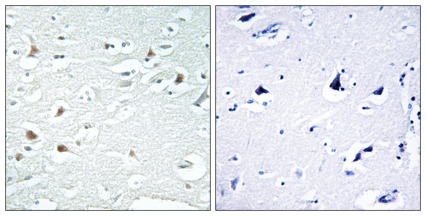 Polyclonal Rabbit anti-Human SNCA / Alpha-Synuclein Antibody (phospho-Tyr125, IHC)