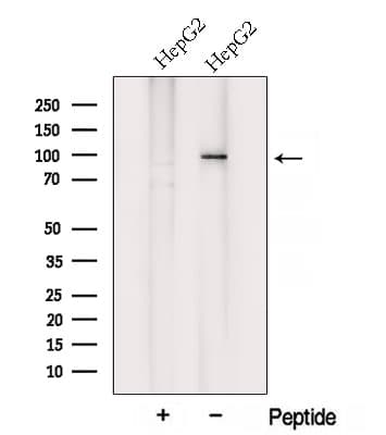 VPS35 Antibody