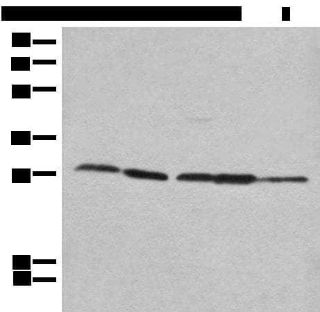 Polyclonal Rabbit anti-Human RPL14 / Ribosomal Protein L14 Antibody (WB)