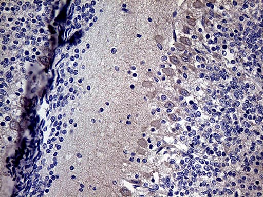 DIRAS2 Antibody (aa1-196, clone OTI10G5)