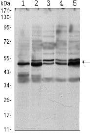 SMAD3 Antibody (clone 5G11)