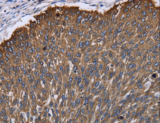 KRT31 / Keratin 31 / KRTHA1 Antibody