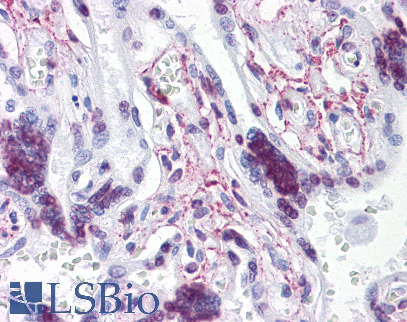 IHC-plus™ Monoclonal Mouse anti-Human ATR Antibody (clone 1E9, IHC)