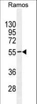 Polyclonal Rabbit anti-Human TSGA10IP Antibody (aa492-520, IHC, WB)