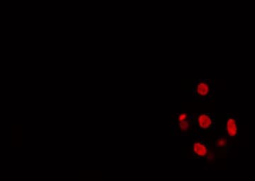 SMARCC2 Antibody