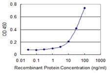 Monoclonal Mouse anti-Human AK9 / AKD1 / AKD2 Antibody (clone 1H8, IHC)