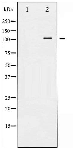 Polyclonal Rabbit anti-Human LIPE / HSL Antibody (phospho-Ser552, IHC, WB)