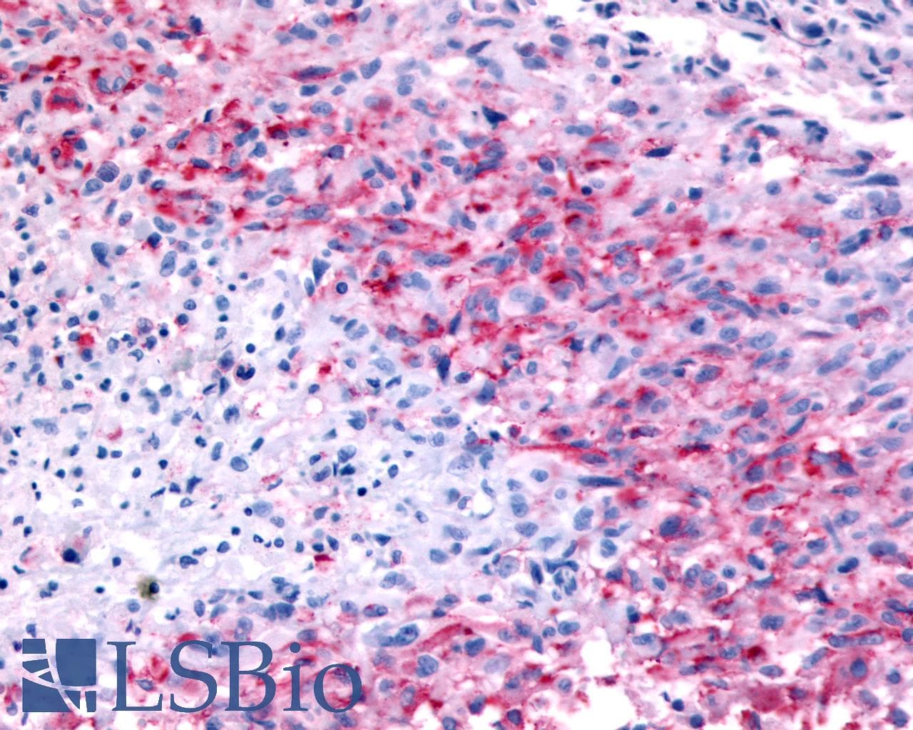 PathPlus™ GPR32 Antibody (Extracellular Domain)