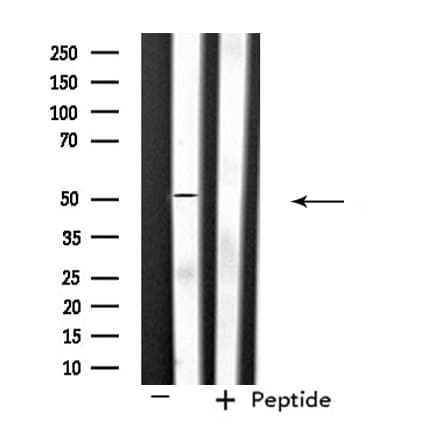 Polyclonal Rabbit anti-Human SLC39A7 / ZIP7 Antibody (IF, WB)