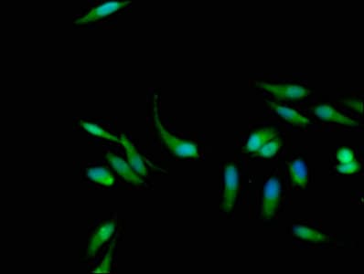IHC-plus™ KRAS Antibody (aa2-168)