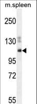 Polyclonal Rabbit anti-Human SYNE3 / C14orf49 Antibody (aa852-880, IHC, WB)