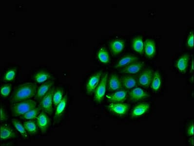 Polyclonal Rabbit anti-Human VASH2 Antibody (IHC, IF, WB)