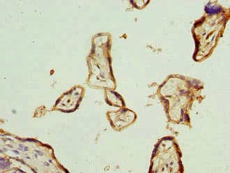 IL-22BP / IL22RA2 Antibody