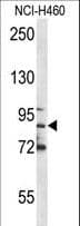 MPO / Myeloperoxidase Antibody (aa548-575)