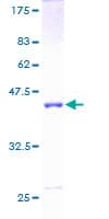 Human UEV1 / UEV1A Protein (Recombinant GST)