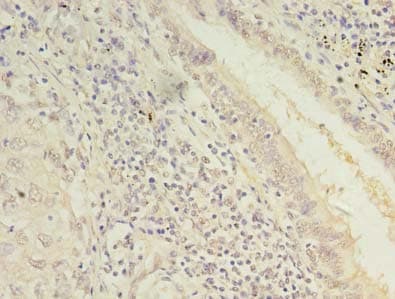 TMEM55A Antibody