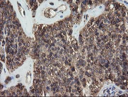 PDIA3 / ERp57 Antibody (clone OTI3E1)