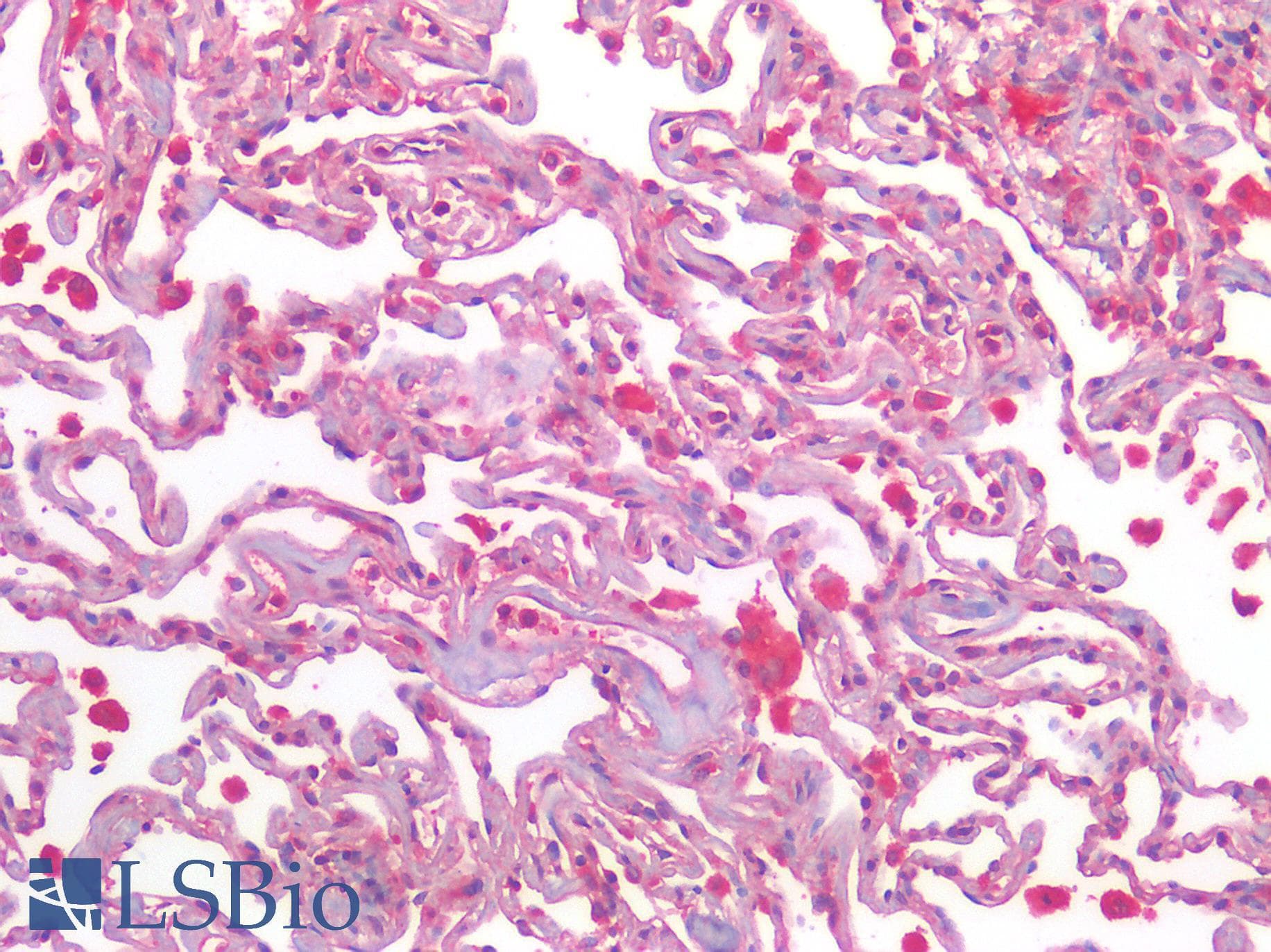 IHC-plus™ AGTR2 / AT2 Receptor Antibody (Internal)