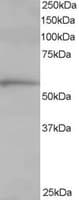 IHC-plus™ TCP1 Antibody (aa544-556)