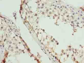 EIF5A2 Antibody