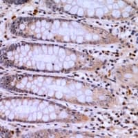 PIK3CB / PI3K Beta Antibody