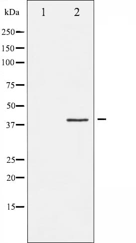 Polyclonal Rabbit anti-Human FOS / c-FOS Antibody (phospho-Ser362, IHC, IF, WB)