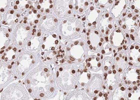 HNRNPL / hnRNP L Antibody