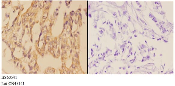 AANAT Antibody