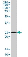 APG5 / ATG5 Antibody (clone 4E7)