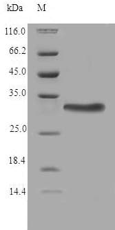 Human TMX2 / TXNDC14 Protein (Recombinant GST, N-terminus)