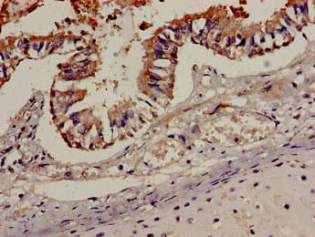 Polyclonal Rabbit anti-Human CCR7 Antibody (IHC, IF)