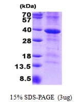 Human CD46 Protein (Recombinant His)