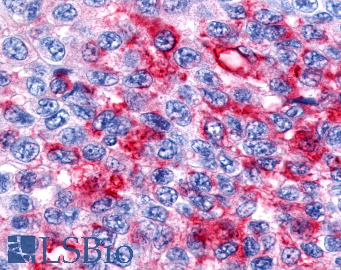 PathPlus™ Polyclonal Rabbit anti-Human RORB / ROR Beta Antibody (Ligand-binding Domain, IHC)