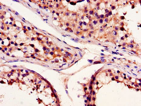 Polyclonal Rabbit anti-Human BCL2A1 Antibody (IHC, IF)